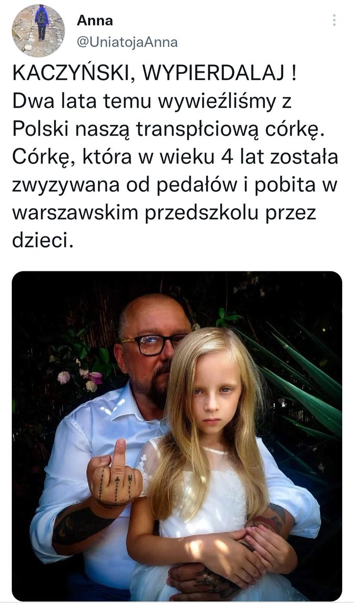 MURMURANDO1996's tweet photo. Tacy rodzice powinni mieć odbierane prawa rodzicielskie za znęcanie się nad dzieckiem. W przypadku 4 letniego dziecka wiadomo że decyzja została podjęta przez rodziców, chorych psychicznie ludzi, znęcających się w ten sposób nad dzieckiem.   #IdeologiaGender #ideologialgbt https://t.co/MXxMWh2lM5