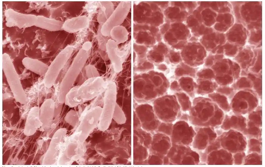 SciencephileG's tweet photo. في مارس 2016, اكتشف علماء من اليابان بكتيريا لديها القدرة حرفياً على "أكل" البلاستيك. (Ideonella sakaiensis) بكتيريا تحلّل نوع من البلاستيك "PET" (البلاستيك المستخدم في العلب) وتستخدمه كنوع من الطاقة. https://t.co/0WfPHCzHAg