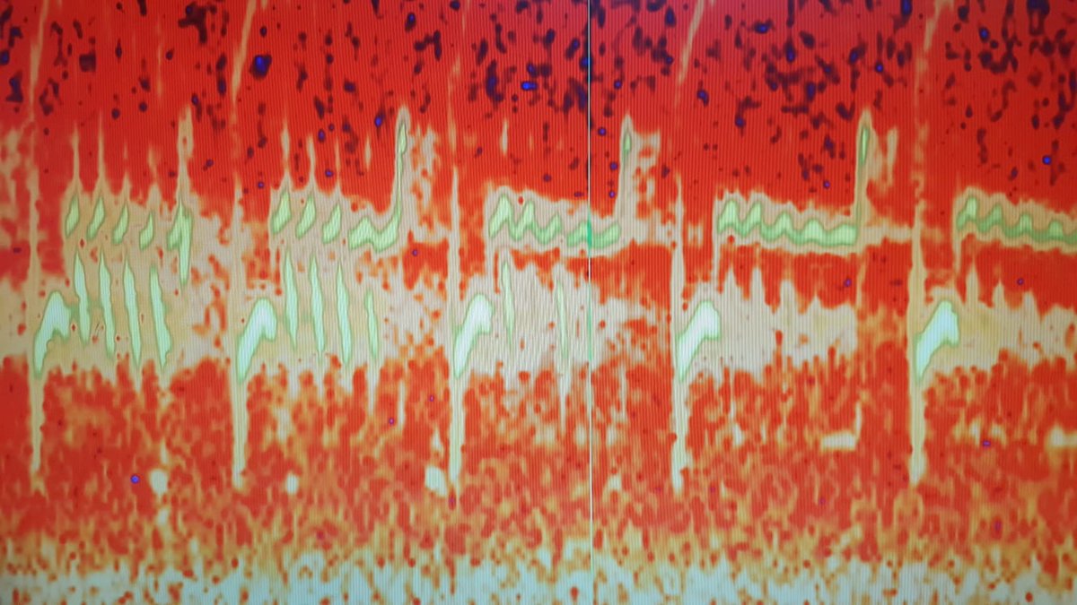journeysinbtwn's tweet photo. Yesterday I got to try speaking Curlew! @pcowdrey's @BirdsongPlanet came to the village with Birdsong Studio - bird song slowed down to be learned by humans, recorded, and sped up again. So much fun! I think you can guess which is which ;)

https://t.co/TliBtUHxQ9 https://t.co/pIsQ1GfO9s