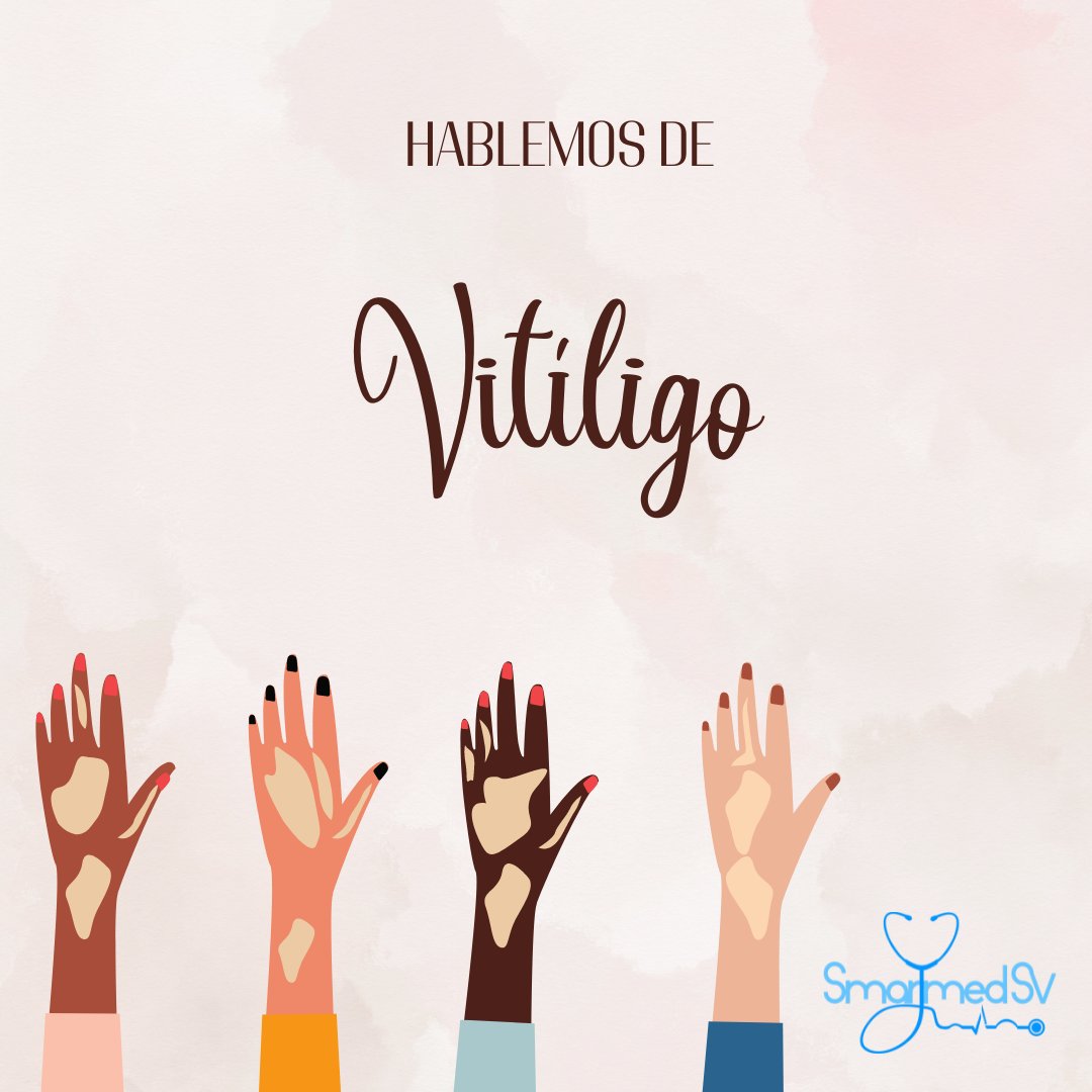 SmartMed_sv's tweet photo. Hablemos un poco de 💥vitiligo💥
Autor: Dr. Roberto Giron
@RobertGiron 
#SmartMed_sv #SmarttalkSV https://t.co/HUt9SKvmvL