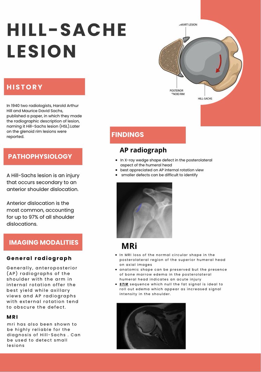 MineRadiology's tweet photo. #Hill_Sache #lesion #shoulder_dislocation #radiograph #MRI #STIR #Radiology https://t.co/aNg4h7VTFh