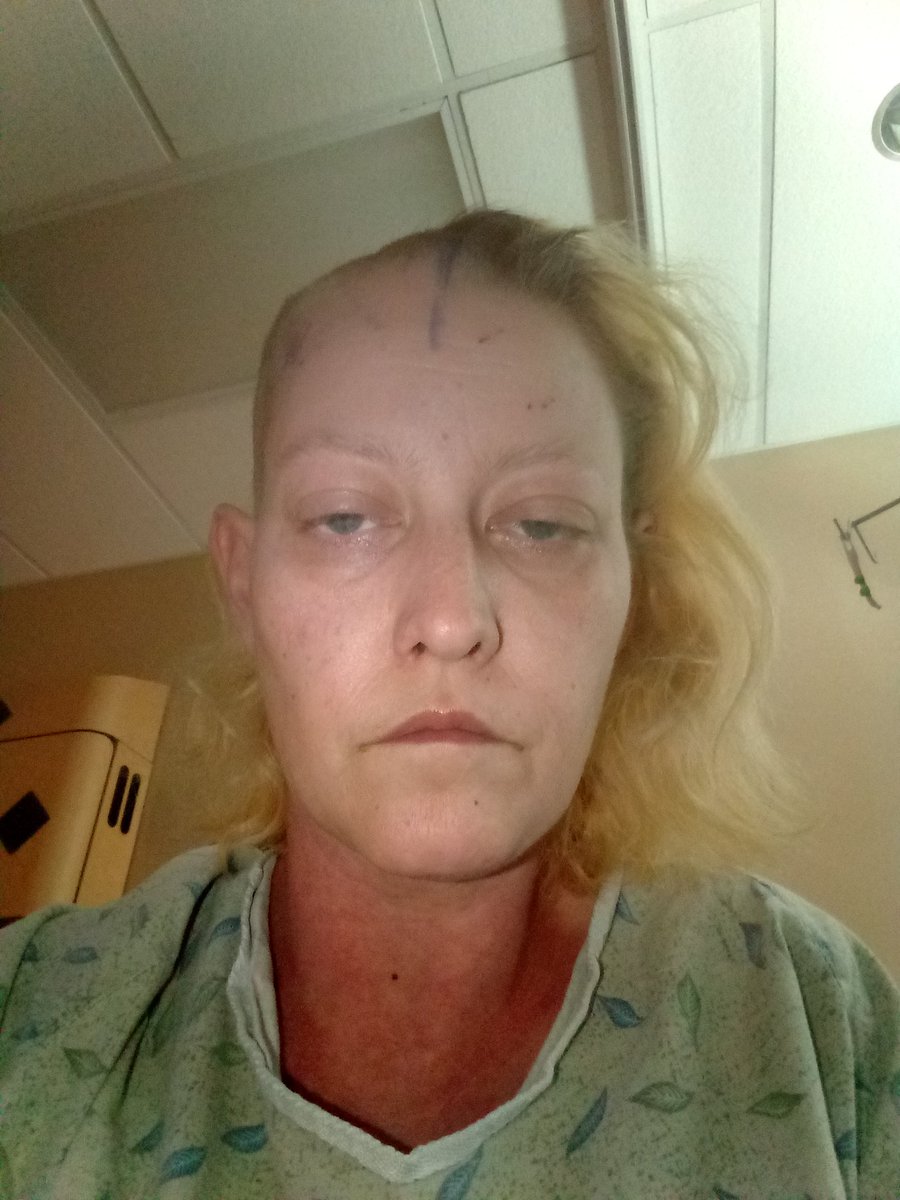 alg85653's tweet photo. @pulte please see this tweet and have mercy on me. I just had surgery again and I struggling to pay the medical bills that keep coming in. Most of all I need help with my husband's meds at the pharmacy. I could really use $25 for his meds $10 and gas $15 to get there $mlgreen8 https://t.co/uJlCpVB72o