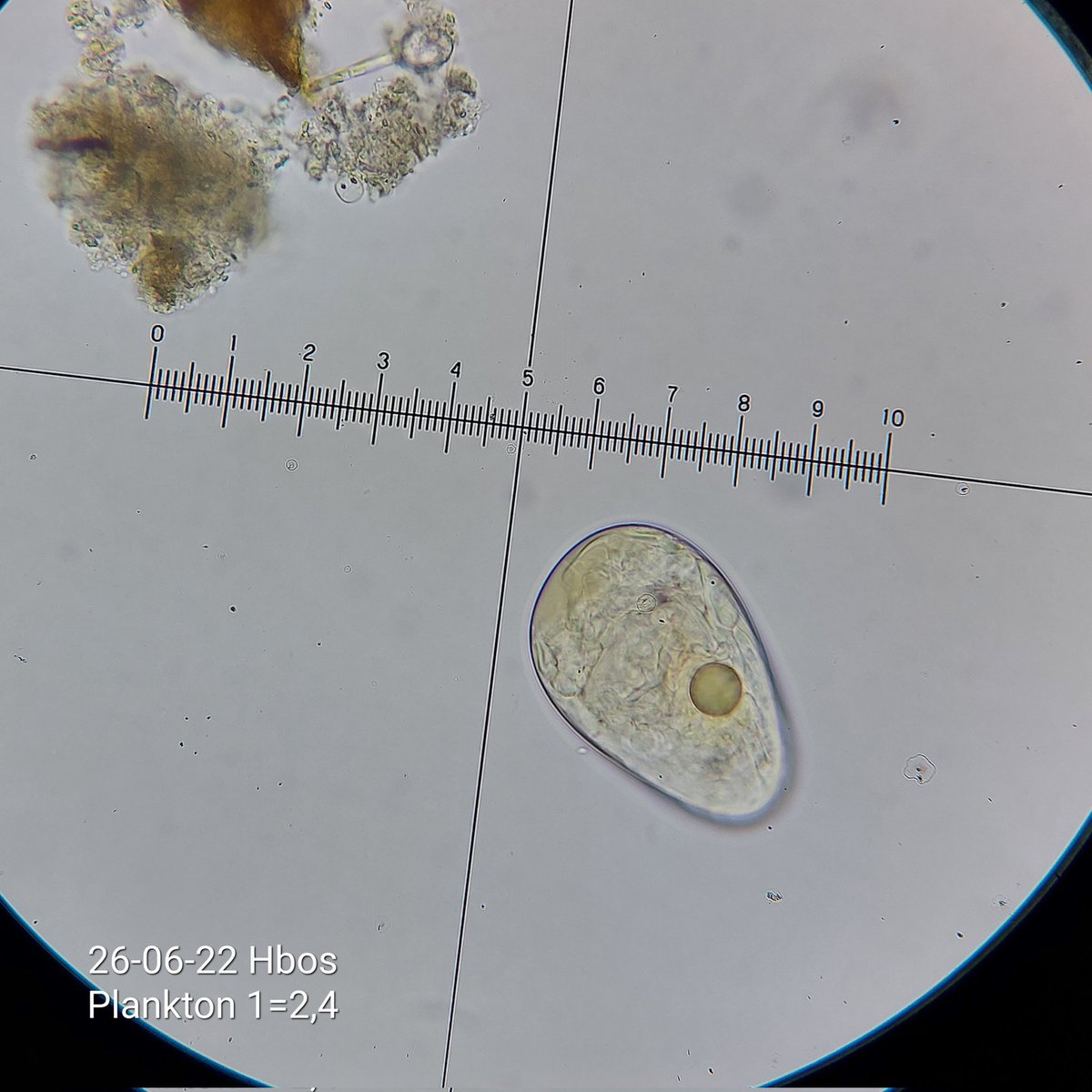 pbhbos's tweet photo. #polyarthra #rotifer with eggs. #plankton lake #Haarlemmermeersebos #freshwater https://t.co/SDkLpQEFSN