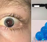 AllMadeToSlave's tweet photo. LIE: Adolescent #EthanLiming had a harmless toy 💦 Water Gun.
(a) EL & Co-conspirators shot at #Akron3
#TylerStafford - 19 YO.
#DeshawnStafford - 20 #DovovonJones - 21 YO with known dangerous Machine Gun modified #SplatRBall with frozen Gel Balls. https://t.co/Aab7ZP0ih6