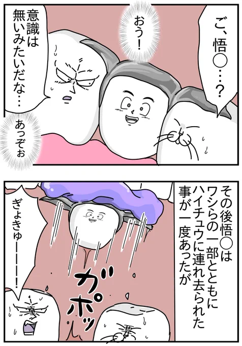ブリッジになった歯と折れた歯① 