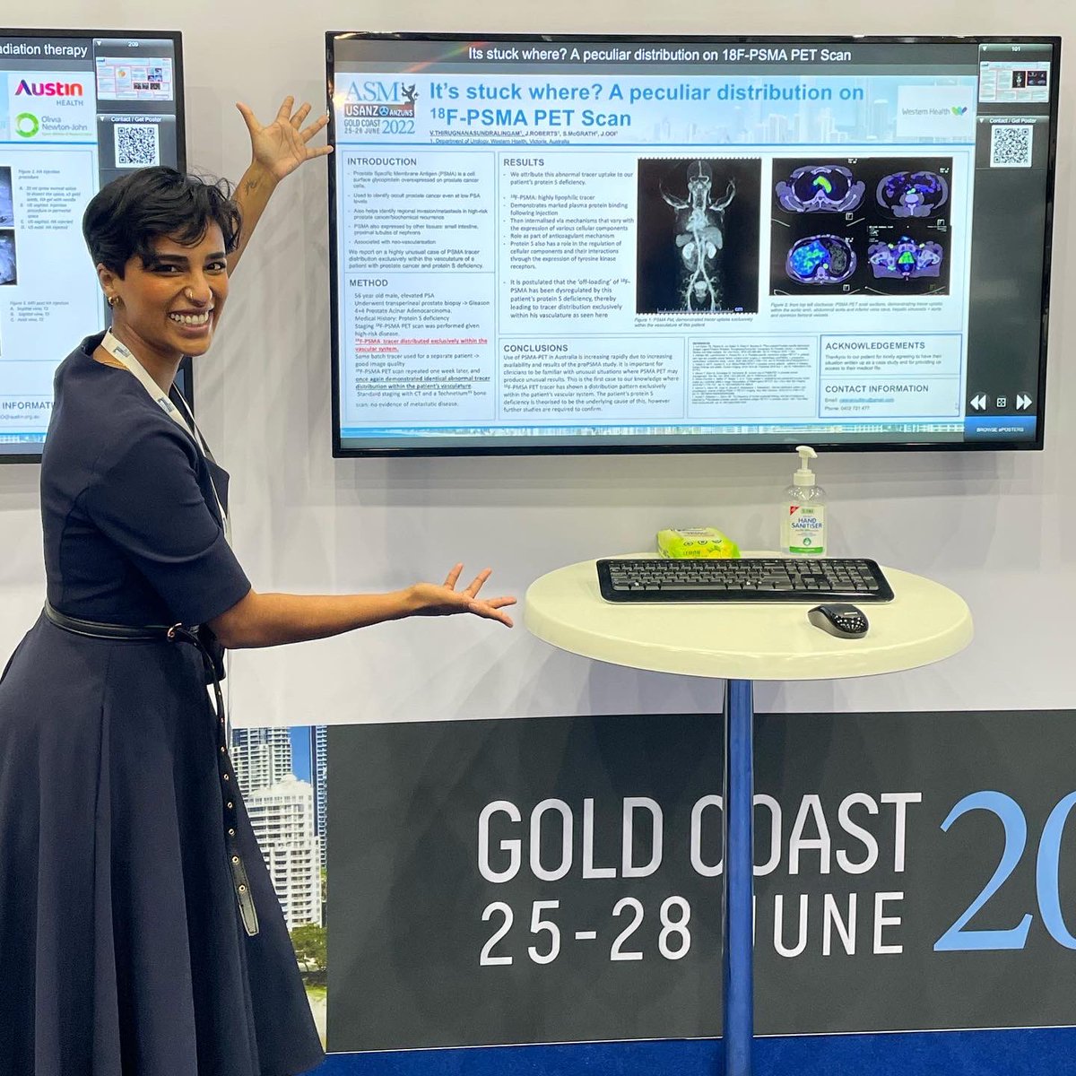 My brilliant sister presents her work on understanding PSMA PET scan distribution #USANZ22 #WomenInSTEM @vaish_thiru