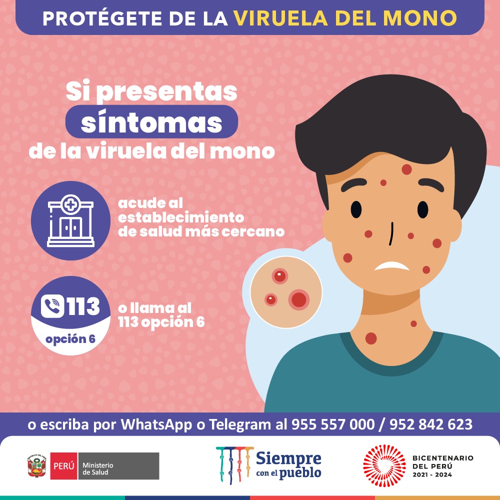 Minsa_Peru's tweet photo. Tras el anuncio del primer caso por #ViruelaDelMono en el país, te brindamos más información sobre esta enfermedad, cuáles son sus síntomas y qué hacer para evitar contagiarse. https://t.co/uz26xJujeR