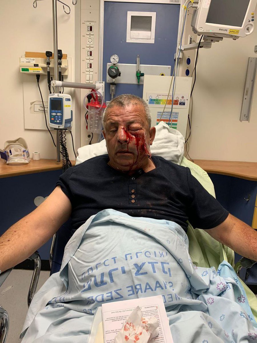 #صورة .. مستوطنون يعتدون على المقدسي عرفات سليم الطحان، ويحرقون مركبته أثناء تواجده في أرضه بمدينة رام الله