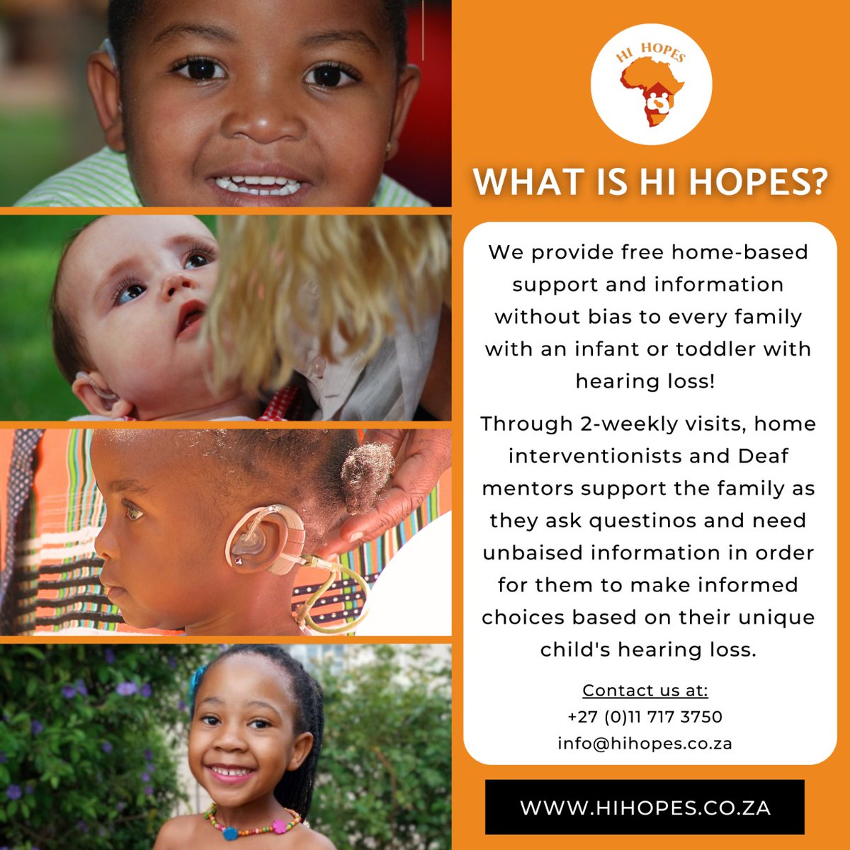 Early intervention enables the natural development of deaf and hard-of-hearing infants. If you suspect your baby can't hear properly, get help. Contact us for more info 0117173750 

#HiHopes #Deaf #HearingLoss #HardofHearing #Infant #Children  #EarlyIntervention #SouthAfrica