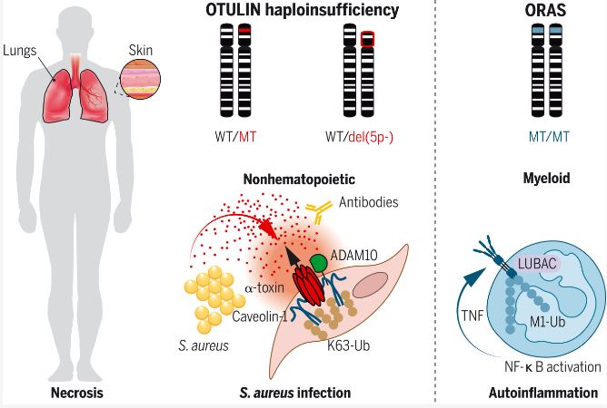 AbarcaPrize's tweet photo. A recent study published in @scienceMagazine by @casanova_lab (award winner of I Edition), @aspaan1 and others, reveals that a rare autosomal dominant haploinsufficiency of #OTULIN impairs intrinsic cellular immunity to #staphylococcal alpha toxin. 

https://t.co/HFv06R1m84 https://t.co/lHfstG3PlW