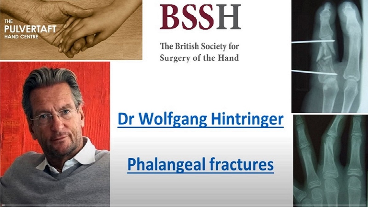 ipokrate's tweet photo. Phalangeal fractures by Dr Wolfgang Hintringer
Watch and learn from the Pulvertaft Videos series on "The management of fractures of the phalanges, including conservative treatment using plaster or thermoplastic splints."
https://t.co/YRlA0yJe1N
#ipokrate #congress #doctor https://t.co/1Bww5VELJS