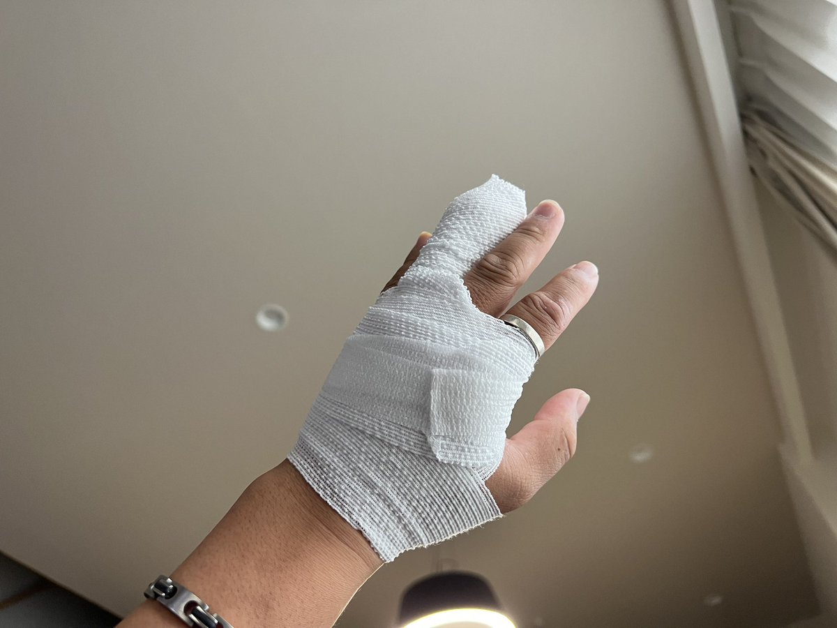 ハサミで指切るとこうなります。

痛てぇ。