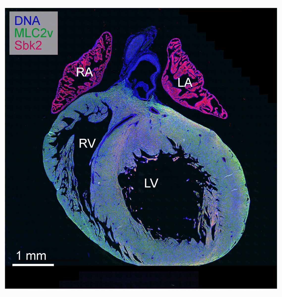 CircRes's tweet photo. van Gorp &amp; colleagues discovered that #Sbk2 plays an important role in the formation of #sarcomeres responsible for #cardiac #contraction. Learn more at https://t.co/xXKJ9EJ8kC    
@UniLeidenNews https://t.co/tGDeXDLcoD