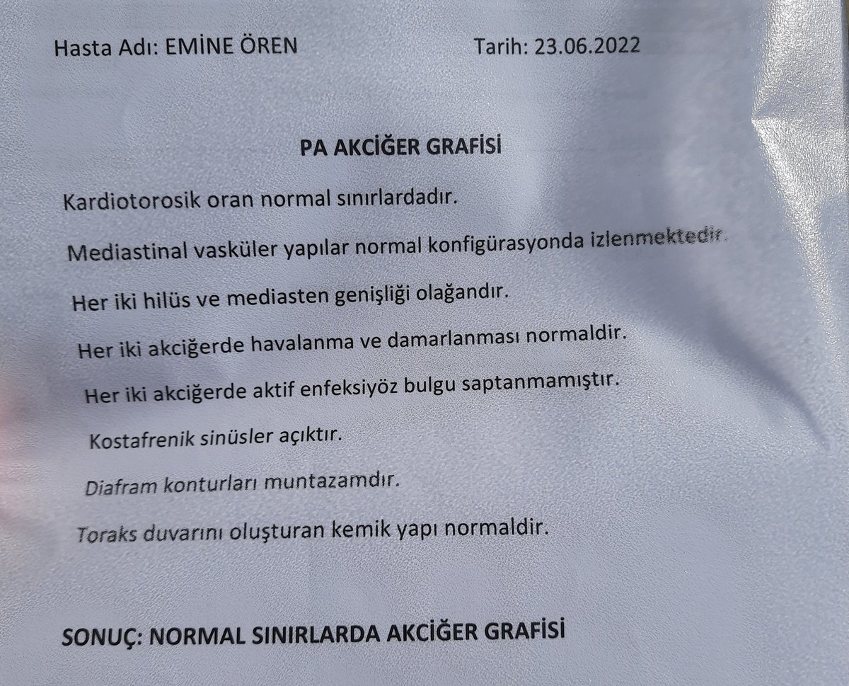 SİGARA ZARARSIZDIR.