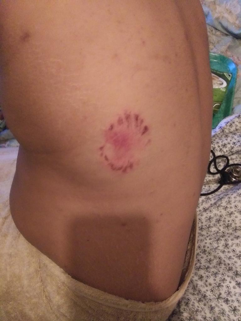 keyworksbishop's tweet photo. Homeless Life is trippy. Never been bit by another human being... This staying in abandoned houses is freaking me out. Went to a friends to get cleaned up for the night but can't take the guilt tripping is too much. Could really use some help. $BishopofdaKey is my cash app. https://t.co/Q5SCIL64w4