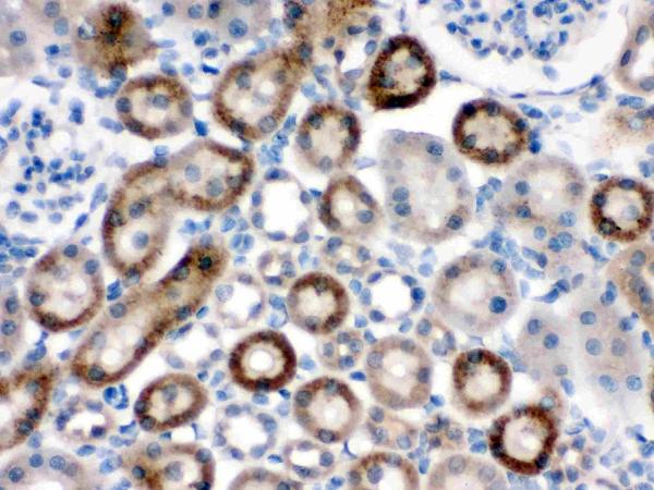 Check out the latest NOX 1 &amp; NOX 5 antibodies from 
<a href="/BosterbioCo/">Boster Bio</a>

#antibodies #polyclonal 
#research 

Click here
antibodyresource.com/site/show/comp…