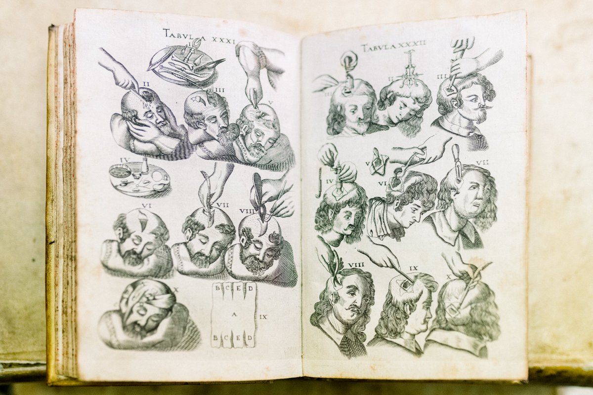 SanMartino_Ge's tweet photo. I tesori del Policlinico tra passato e futuro

La Biblioteca
19.000 volumi e 1.300 periodici: è la Biblioteca biomedica più grande della Liguria.
Conserva opere a tema medico scientifico dal 1500 ad oggi.

Nella foto: Armamentarium chirurgicum, Johannes Schultes, 1665 https://t.co/sSSB94D1uw