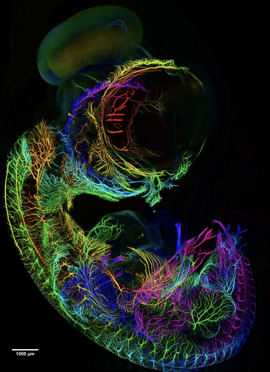 Richard Behringer (@rrbehringer) on Twitter photo Developing nervous system of a 7-day old chick embryo captured with a mesoSPIM microscope. Image: mesospim.org <a href="/SocDevBio/">Society for Developmental Biology</a> Developing nervous system of a 7-day old chick embryo captured with a mesoSPIM microscope. Image: mesospim.org <a href="/SocDevBio/">Society for Developmental Biology</a>