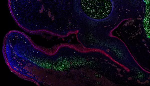 CCRB27's tweet photo. #MeetCCRB: Tucker group is fascinated by the development of the head, with a focus on the jaw, teeth and ear. Formation of these structures involves complex interactions, and we are interested in how the various cells and tissues talk to each other to make a functioning organ. https://t.co/gwTcyWM3bP