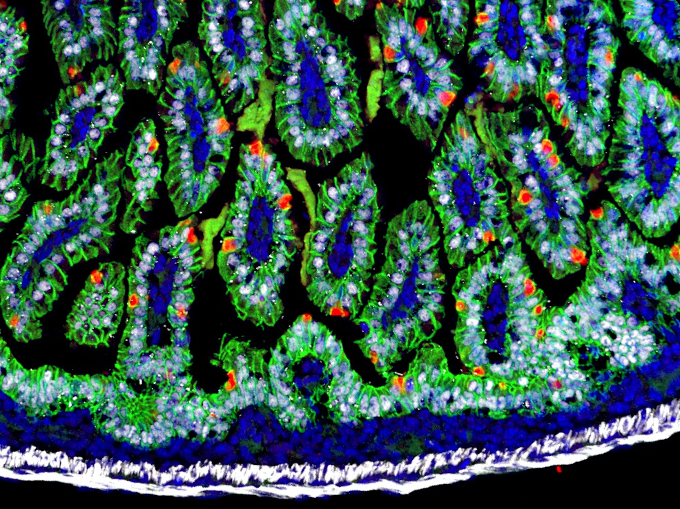 E16.5 mouse small intestine stained for CDH1 (green), MUC2 (red), HNF4A (white) and DAPI (blue)
#MicroscopyMonday #bioart #sciart #pathart #histoart #microscopy