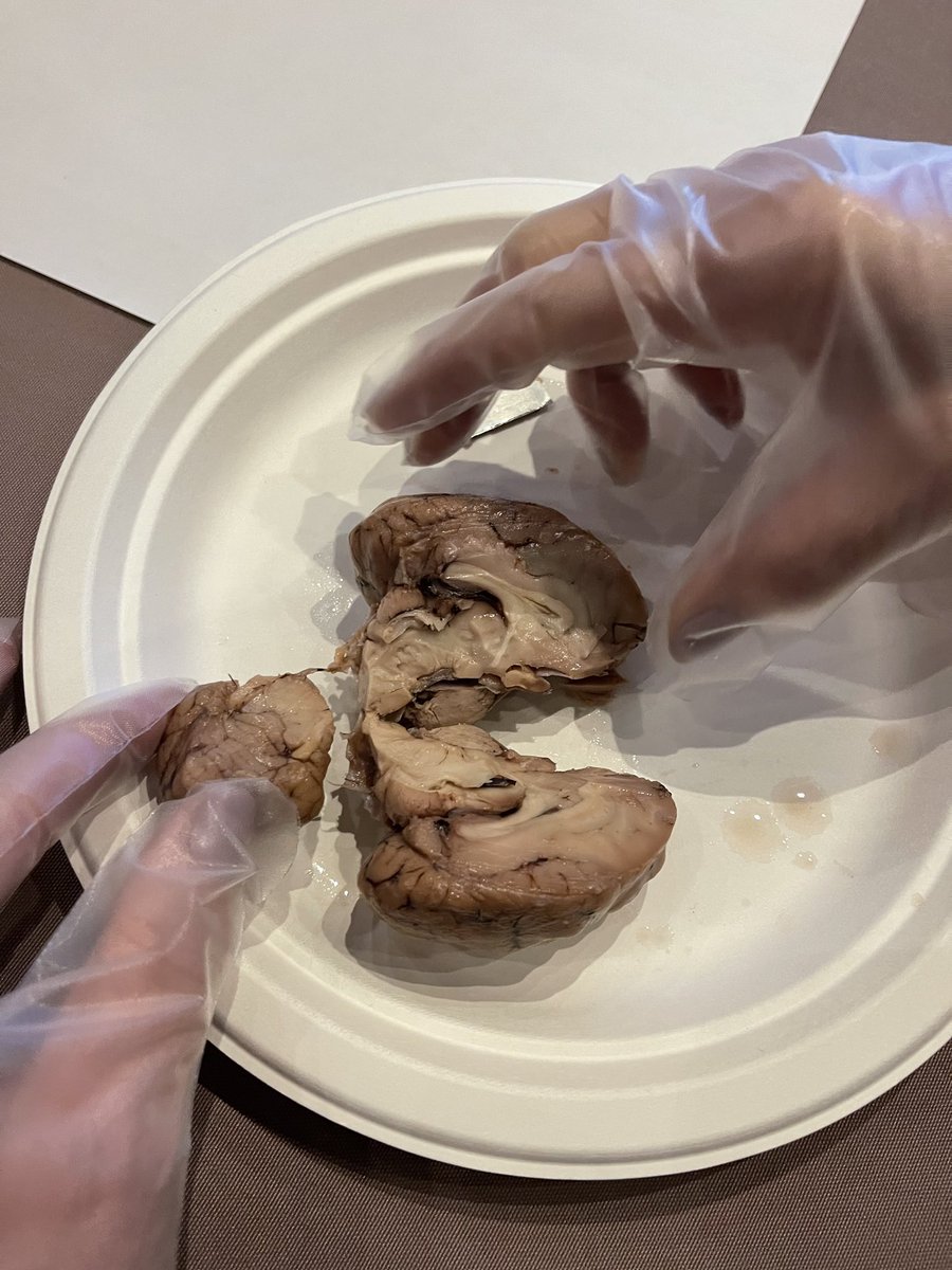 Learning all about the brain! #MSC2022