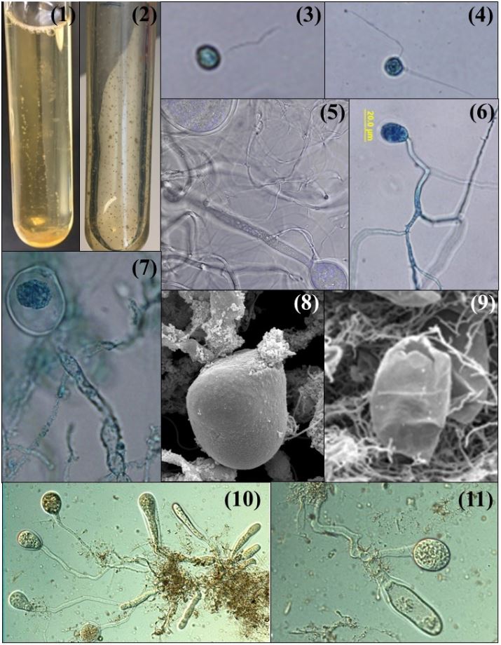 The genus name, Capellomyces, is derived from the Latin word for goat as it was first isolated from goat. The morphological features of Capellomyces are monocentric thallus, filamentous rhizoidal system, and monoflagellated zoospores.
#anaerobicfungi #taxonomy