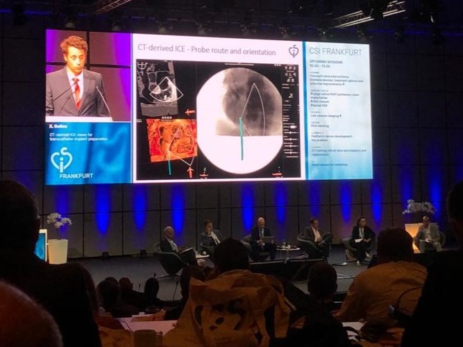 Pie_Med_Imaging's tweet photo. Looking back at a great CSI conference last week!

Next to CT planning workshops lead by Dr. @DeeDeeWangMD, Dr. Martin Swaans and Dr. @OKhaliqueMD, there were stunning presentations on CT derived ICE views (Dr. Galloo) and CT planning of pulm. valve interventions (Dr. ten Cate). https://t.co/qebNUrW4Mg