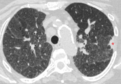 Ramsy Abdelghani, MD tweet media