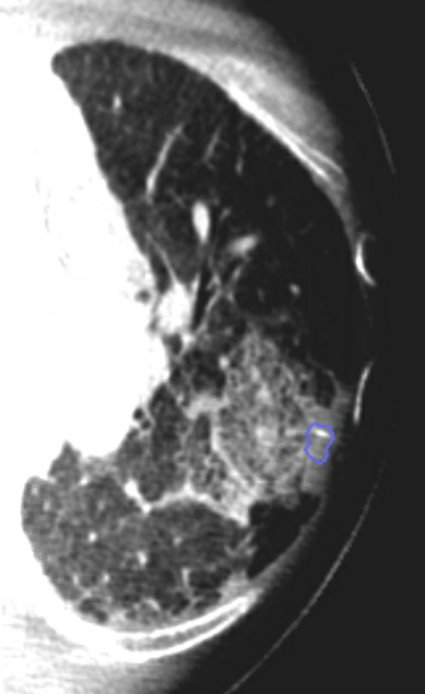 Ramsy Abdelghani, MD tweet media