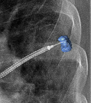 Ramsy Abdelghani, MD tweet media