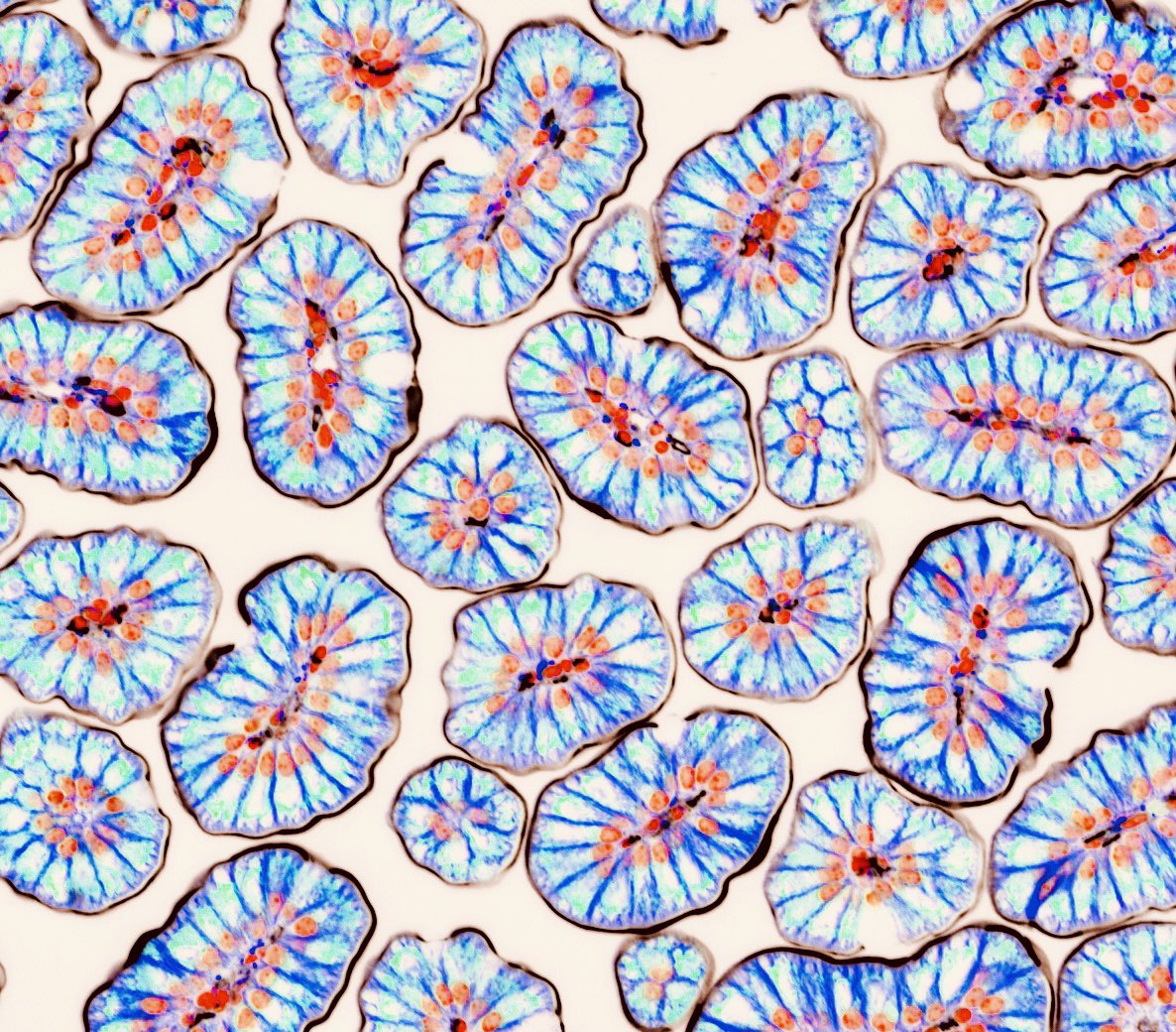 #MicroscopyMonday featuring neonatal small intestine stained for alpha tubulin in dark blue, lysosomes in light blue, nuclei in orange and apical membrane in brown. 

#microscopy #bioart #sciart #histoart #pathart #science