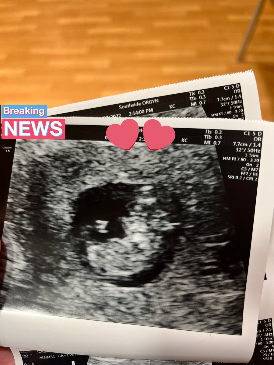JulbertBri's tweet photo. Someone’s so excited for his new baby brother to come 💙🌀 https://t.co/2rvDnbmKnV