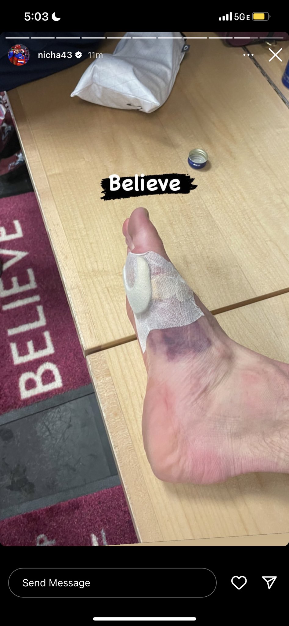 Peter Baugh on Twitter "Valeri Nichushkin played through a foot injury