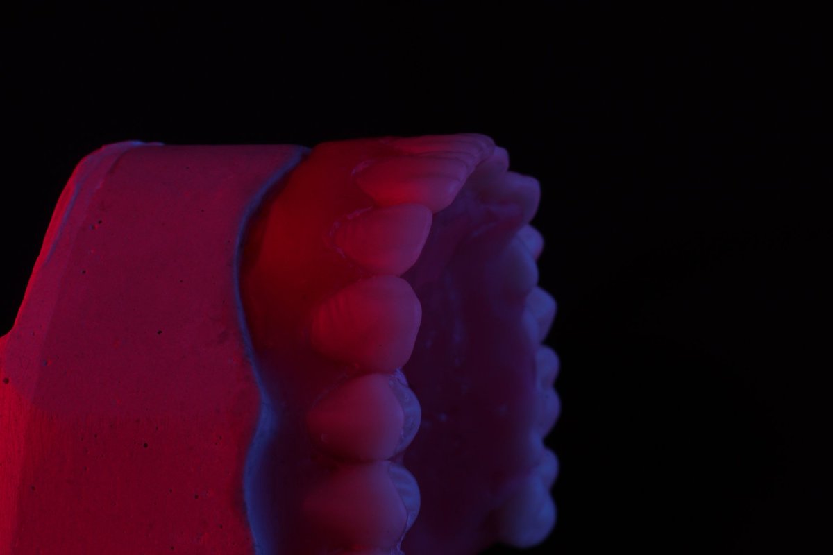 AlexGuzdri's tweet photo. Amigos les quiero compartir las fotos que aprendí a tomar en un curso de fotografía dental 🦷
📸: Yo merengues https://t.co/2P9USbv6Rr
