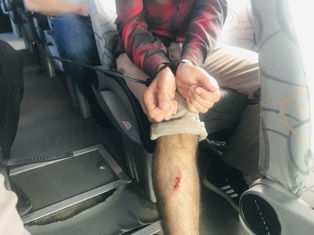furkanhabernet's tweet photo. Furkan Hareketi Mensuplarına Darp!

Osmaniye'de Kur'an Okunan Evin Mühürlemesine Tepki Veren Furkan Hareketi Mensupları Gözlatına Alınırken Darp Edildi!

#OsmaniyeEmniyeti https://t.co/qYqTC0bHMA