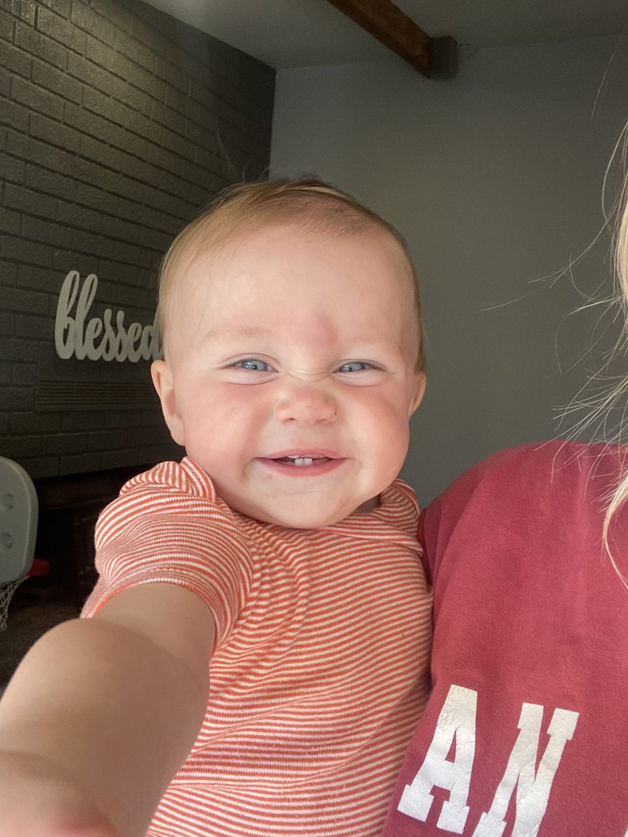 snmiller04's tweet photo. Conner hit his head on our fireplace but his cheesy smile 🥹🥹😭 https://t.co/9bGnZvB8Fv