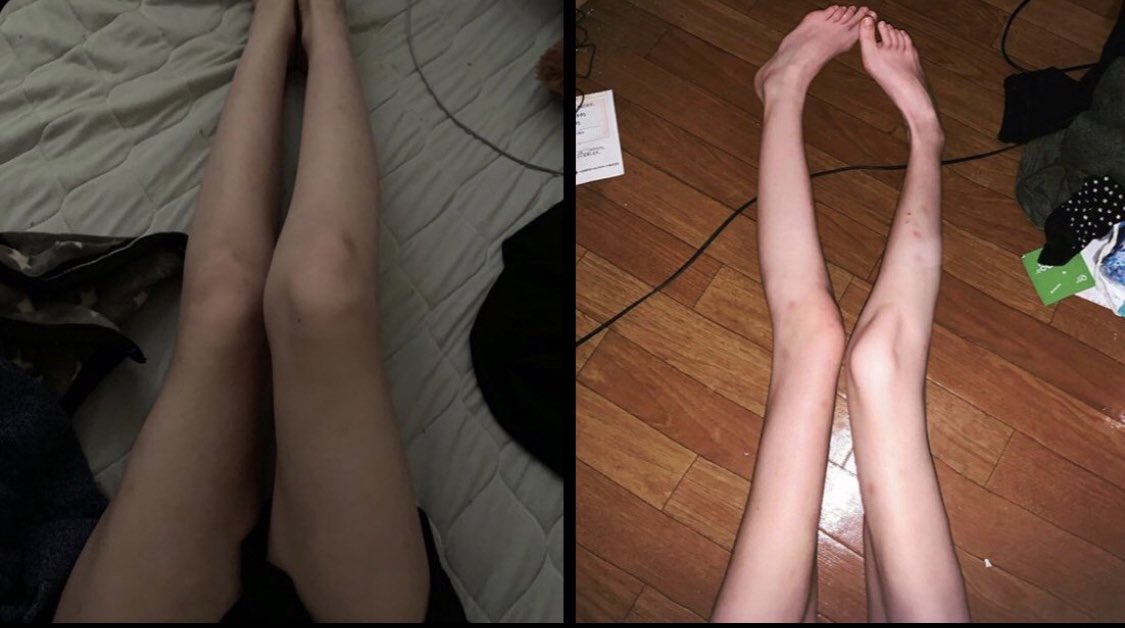 edenkcaI's tweet photo. before                                after https://t.co/aURtNlMHyb