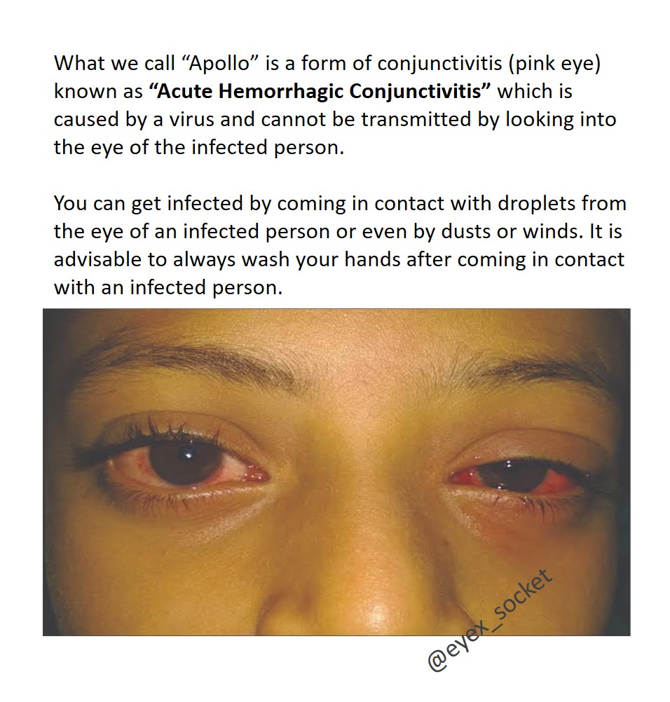 eyex_socket's tweet photo. Did you know?
#EyeSocket #eyexsocket #eyehealth #FACT #healthinfo #optometry #sight #vision https://t.co/Rdh18OsHtf