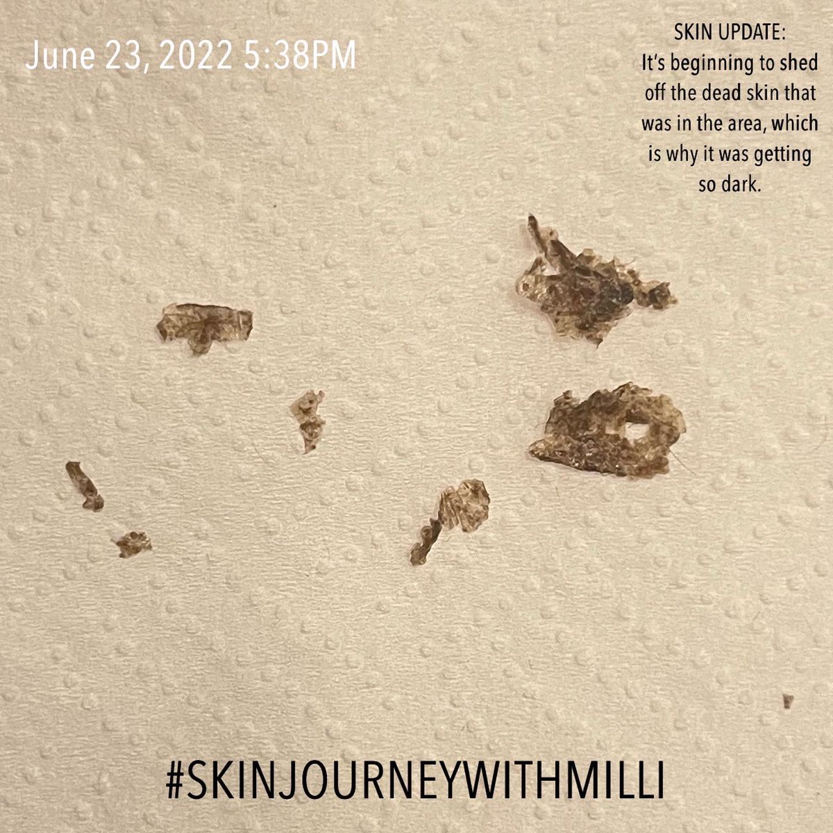 MilliCleanse's tweet photo. Start your #SKINJOURNEYWITHMILLI today! 🔥🔥

ALL NATURAL | BLACKOWNED | REAL RESULTS 

Get products as low as $6 using AfterPay 👇🏾👇🏾👇🏾👇🏾👇🏾👇🏾👇🏾
https://t.co/uCgiOxBgSD https://t.co/6nYP60WU79