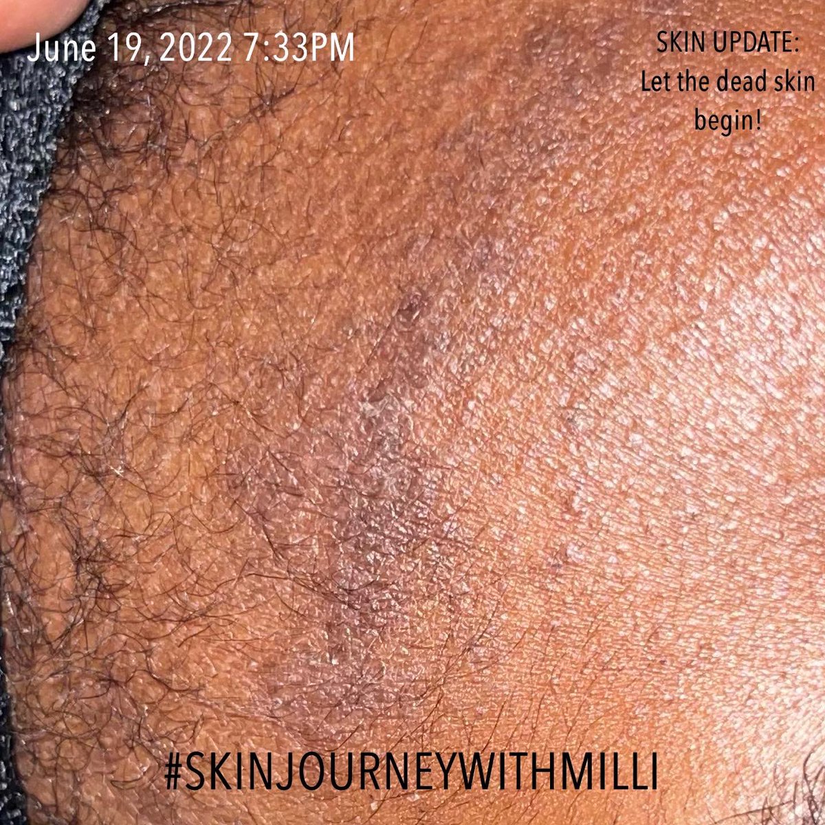 MilliCleanse's tweet photo. Start your #SKINJOURNEYWITHMILLI today! 🔥🔥

ALL NATURAL | BLACKOWNED | REAL RESULTS 

Get products as low as $6 using AfterPay 👇🏾👇🏾👇🏾👇🏾👇🏾👇🏾👇🏾
https://t.co/uCgiOxBgSD https://t.co/6nYP60WU79