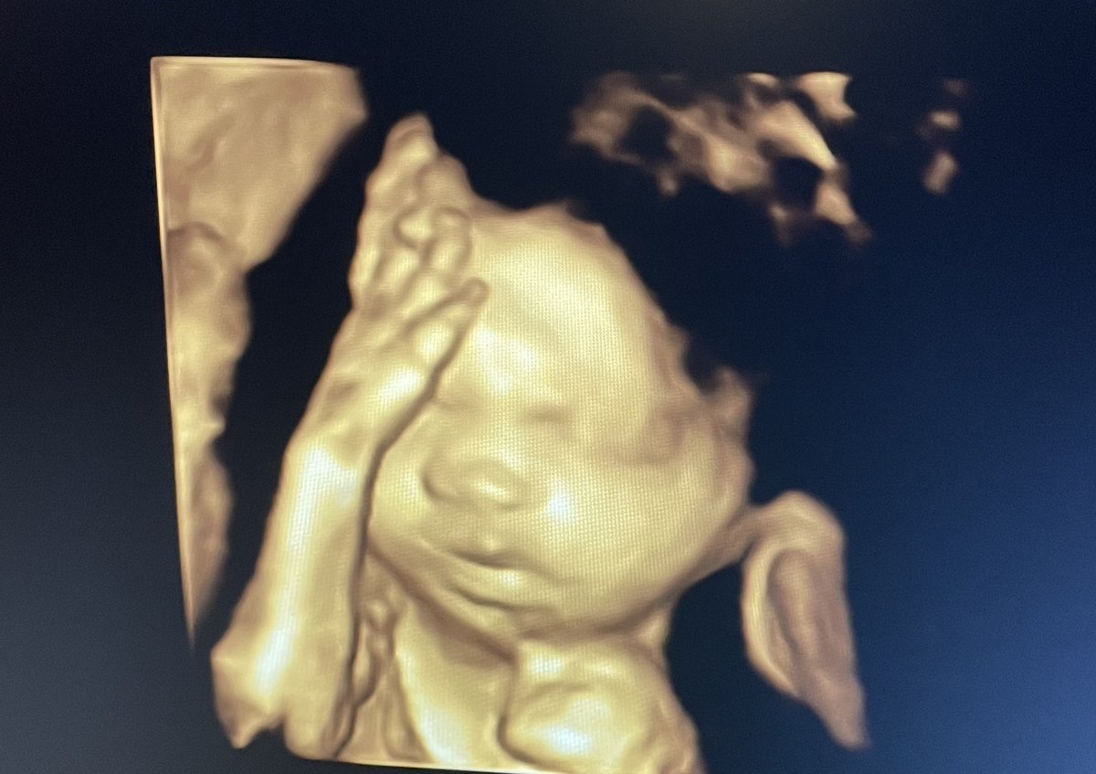 iNJAE_weTRUST's tweet photo. Baby B 💙🧸 https://t.co/irFMSsEWyB
