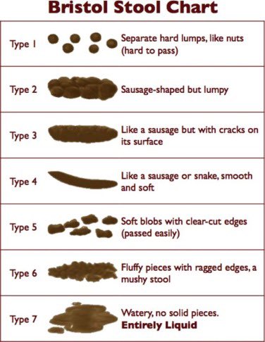 Diarrhea & constipation can be very subjective terms. Stool frequency and consistency are more useful for determining the best management strategy. The Bristol Stool scale is a useful tool. NB the higher the number the higher water content of the 💩 #GItwitter #MedEd #MedTwitter