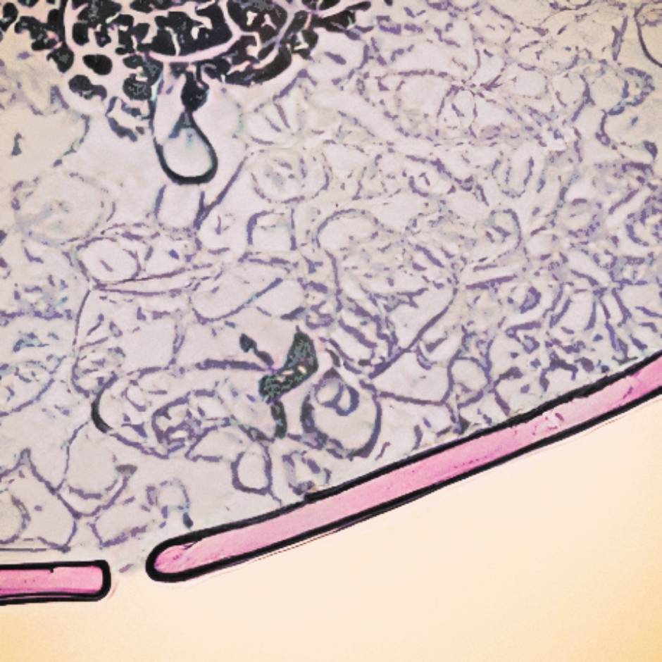 #_tn__bio_
Transcripts are transported out of the nucleus into the cellular cytoplasm, through pores in the nuclear envelope.