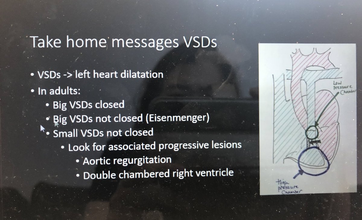 When not to jump in and close #ASD?Take home messages for #ASD #VSD #ACHD Brilliant talk by Dr Joanna Lim @CardioWebinar 🙌@TheBJCA @damandev @ChengKenOng @Khalemedic @KhaingZ79354646