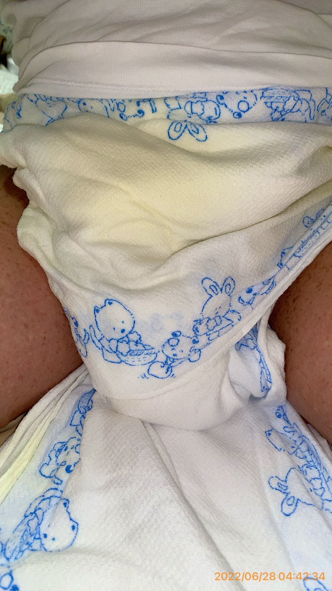 onesho2diaper's tweet photo. 日�� 2022.6. 28 火 おねしょの朝
気持ちよく目が覚めた
おむつが濡れているのに気がついた
まだ　#おしっこ　がお腹に残ってる感じです

#おむつ　#おねしょ https://t.co/AmoPFow0OZ