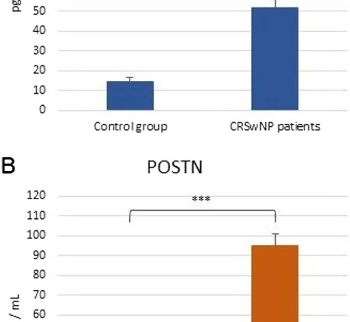 Aller_MD's tweet photo. Serum #IL5, #POSTN and #IL33 levels in #chronic #rhinosinusitis with #nasal #polyposis correlate with #clinical #severity https://t.co/cBU8Bj79sg https://t.co/Fcw4M7lckW