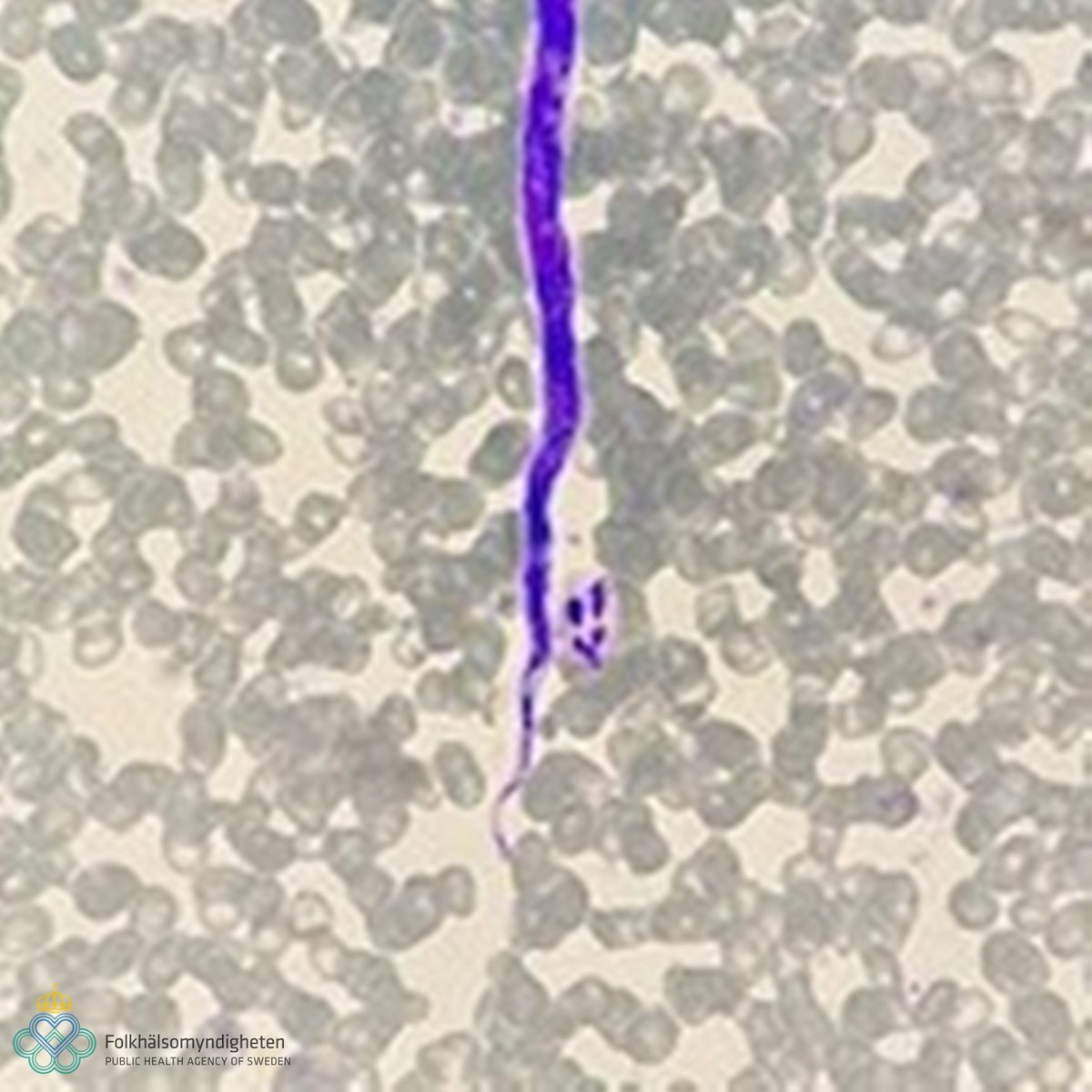 ParasiteGal's tweet photo. #Parasite Case 687 up – Found in blood from a patient from Gabon. Donated by @IoanaBujila 

See the cool videos here: https://t.co/JmhQ6HuV8R Identification? 

#pathology #path2path #MayoClinMicro #CrittersonTwitter #PathBugs #idpath https://t.co/4HE258Ao0t