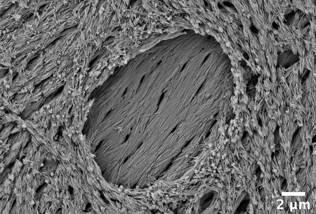 Through the eyes of an #osteocyte. In #bone, this is what the environment of partially embedded osteocytes (osteoblastic–osteocytes) is like!

#MicroscopyMonday #Microscopy @zeiss_micro #biology #imaging #biomineralization #extracellularmatrix

Read more:
doi.org/10.1007/s00223…