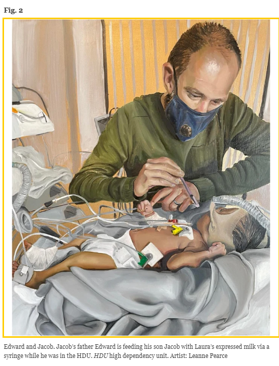 "Using art to raise awareness of breastfed children with medical complexity" 
#IntBreastfeedJ article by <a href="/FeedSleepBond/">Dr Lyndsey Hookway</a> with paintings by <a href="/leanne_artist/">Leanne Pearce Artist</a> 
#pediatrics #NICU 
tinyurl.com/58hjxr36