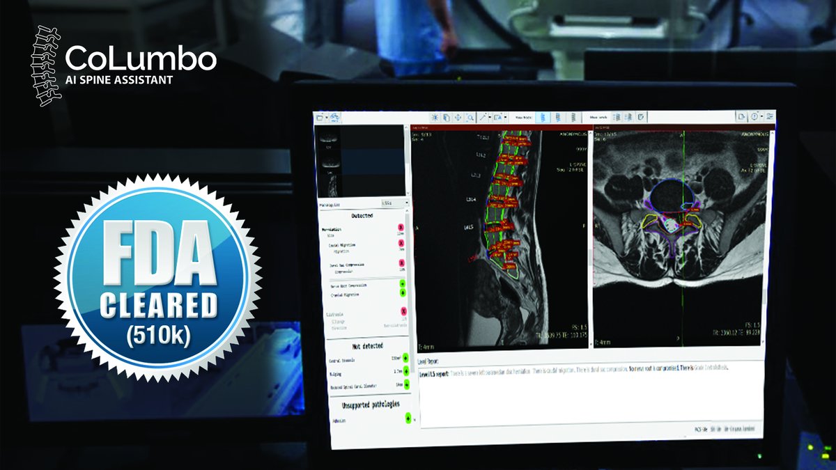Smart Soft Healthcare is honoured to announce that CoLumbo became the world’s first lumbar spine AI assistant software for MRI modality to receive an FDA 510(K) clearance. This will enable the CoLumbo expansion to the USA market and benefit millions of patients with spine pains.